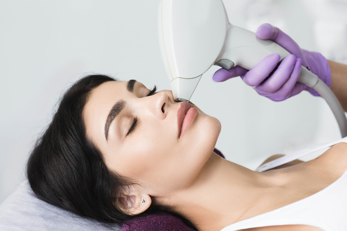 لیزر موهای زائد در تهران غرب